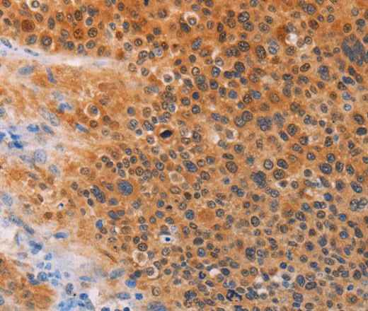 Anti-Human/Mouse/Rat ADHFE1 Antibody