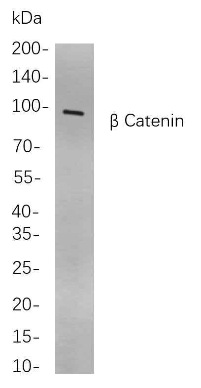 Anti-Human/Mouse/Rat β Catenin Antibody [B850] - ABMIUM