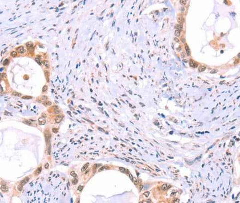 Anti-Human PROS1 Antibody