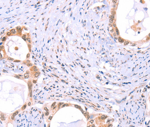 Anti-Human PROS1 Antibody - ABMIUM