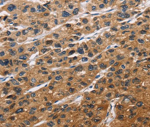 Anti-Human/Mouse EIF4EBP2 Antibody - ABMIUM