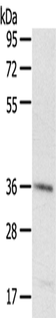Anti-Human/Mouse/Rat PDLIM4 Antibody - ABMIUM