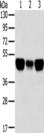 Anti-Human TRIM21 Antibody - ABMIUM