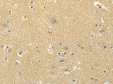 Anti-Human/Mouse/Rat MSI1 Antibody - ABMIUM