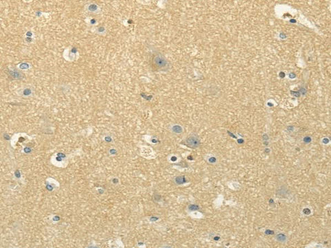 Anti-Human/Mouse/Rat MSI1 Antibody - ABMIUM