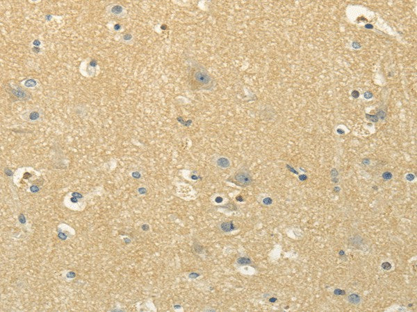 Anti-Human/Mouse/Rat MSI1 Antibody - ABMIUM