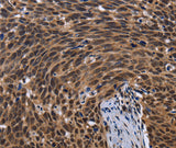 Anti-Human FASTKD5 Antibody - ABMIUM