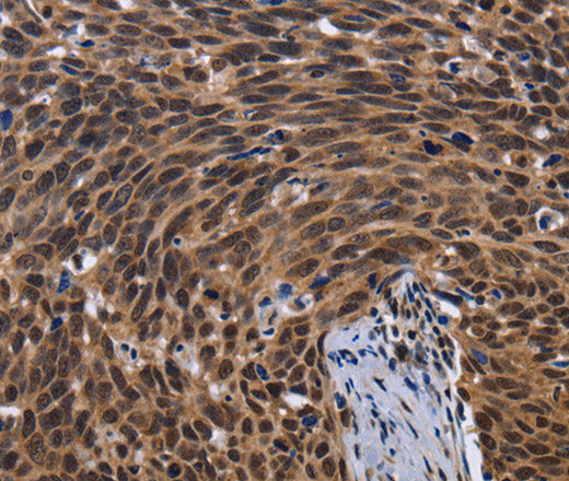 Anti-Human FASTKD5 Antibody - ABMIUM