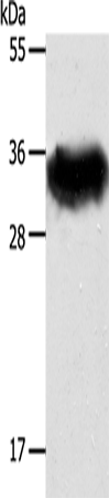 Anti-Human/Mouse/Rat STX1A Antibody - ABMIUM