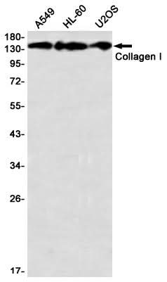 Western blot detection of Collagen I in A549,HL-60,U2OS using Collagen I Rabbit mAb(1:1000 diluted)