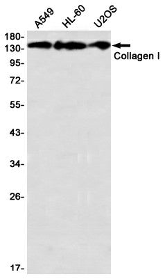 Western blot detection of Collagen I in A549,HL-60,U2OS using Collagen I Rabbit mAb(1:1000 diluted)