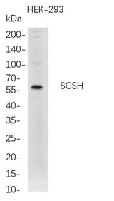 Anti-Human SGSH Antibody [B729]