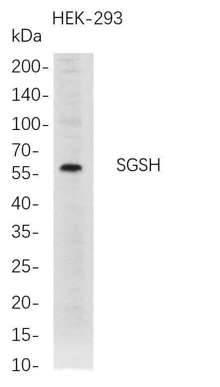 Anti-Human SGSH Antibody [B729] - ABMIUM