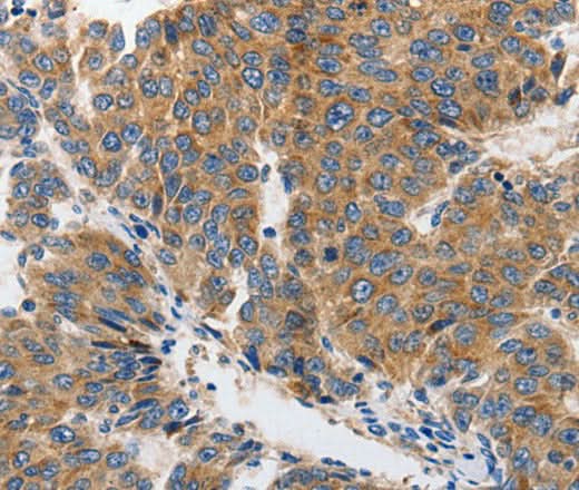 Anti-Human/Mouse/Rat GRIA2 Antibody - ABMIUM