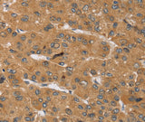 Anti-Human/Mouse/Rat KCNJ15 Antibody - ABMIUM