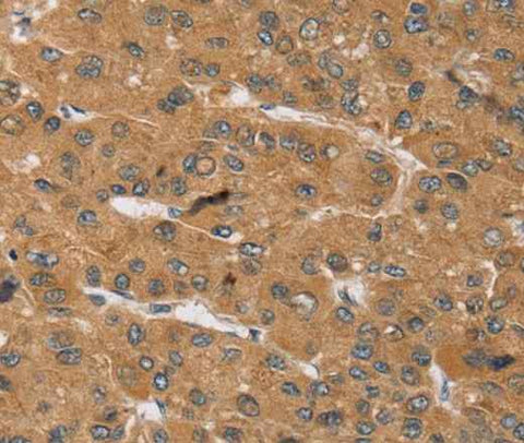 Anti-Human/Mouse/Rat KCNJ15 Antibody