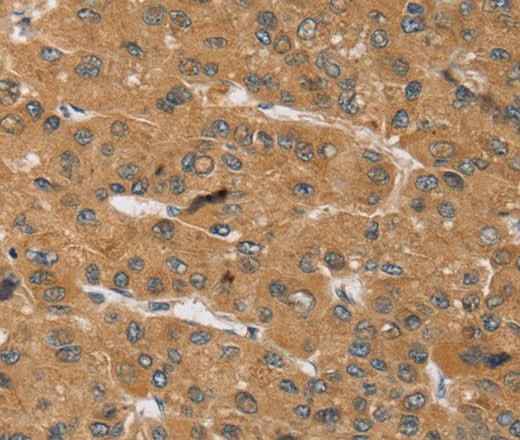 Anti-Human/Mouse/Rat KCNJ15 Antibody