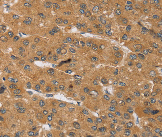 Anti-Human/Mouse/Rat KCNJ15 Antibody - ABMIUM