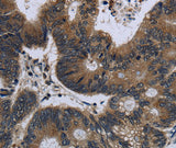 Anti-Human/Mouse/Rat GK Antibody - ABMIUM