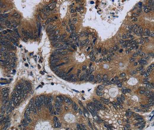 Anti-Human/Mouse/Rat GK Antibody