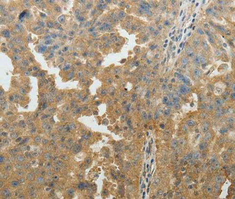 Anti-Human/Mouse/Rat SYT6 Antibody
