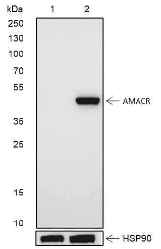 Anti-Human AMACR Antibody [A110] - ABMIUM