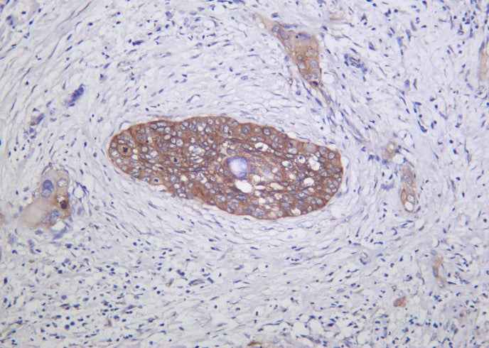 Anti-Human/Mouse/Rat Integrin α2 Antibody [B1054]