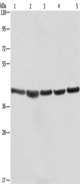 Anti-Human/Mouse/Rat RPSA Antibody - ABMIUM