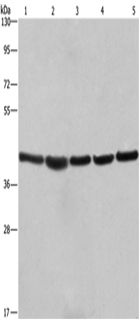 Anti-Human/Mouse/Rat RPSA Antibody - ABMIUM