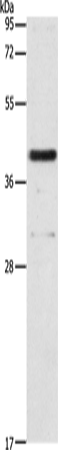 Anti-Human/Mouse/Rat PAFAH2 Antibody - ABMIUM