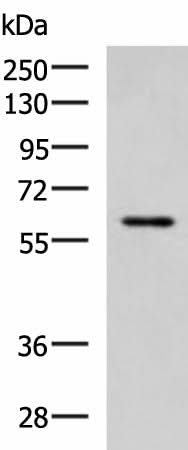 Western blot analysis of MCF7 cell lysate using ECM1 Polyclonal Antibody at dilution of 1:1000