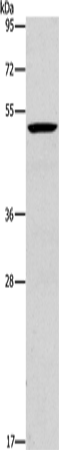 Anti-Human/Mouse PLIN2 Antibody - ABMIUM