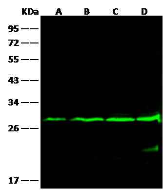 Anti-Human BCL2 Antibody [A1021] - ABMIUM
