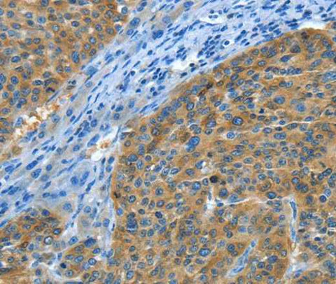 Anti-Human Amphiphysin II Antibody