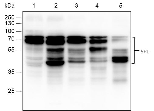 Anti-Human/Rat/Mouse SF1 Antibody [A791] - ABMIUM