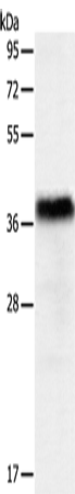 Anti-Human PGBD2 Antibody - ABMIUM