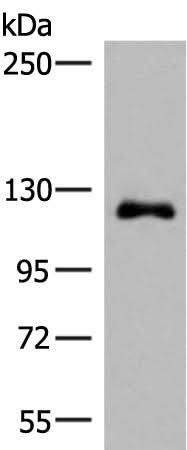 Western blot analysis of A375 cell lysate using ARHGAP45 Polyclonal Antibody at dilution of 1:700