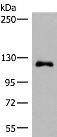 Western blot analysis of A375 cell lysate using ARHGAP45 Polyclonal Antibody at dilution of 1:700
