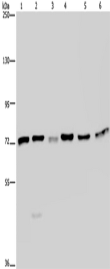Anti-Human/Mouse/Rat KARS Antibody - ABMIUM