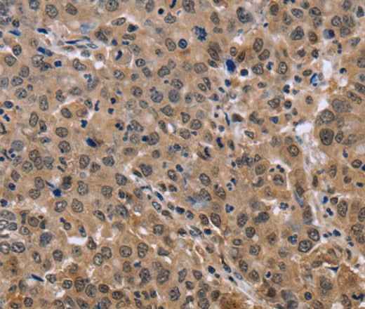 Anti-Human KIF25 Antibody