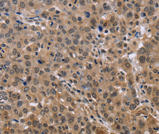 Anti-Human KIF25 Antibody - ABMIUM