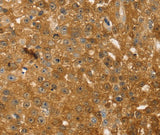 Anti-Human/Mouse/Rat TMSB10 Antibody - ABMIUM