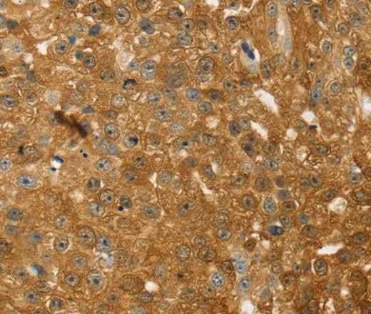 Anti-Human/Mouse/Rat TMSB10 Antibody