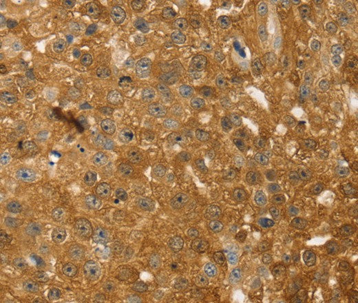 Anti-Human/Mouse/Rat TMSB10 Antibody - ABMIUM