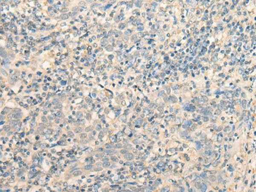Anti-Human MR1 Antibody