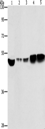 Anti-Human/Mouse/Rat ENO1 Antibody - ABMIUM