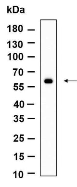 Anti-Human/Mouse/Rat PAKγ Antibody [B951]