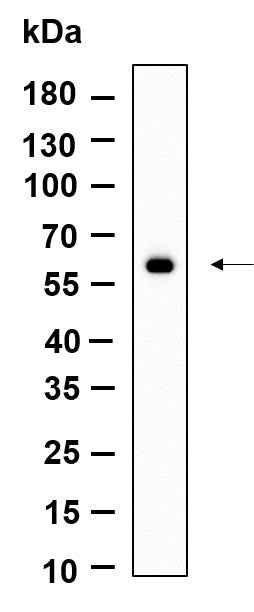 Anti-Human/Mouse/Rat PAKγ Antibody [B951] - ABMIUM
