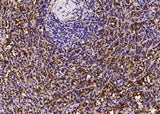 Anti-Human FCGR3A Antibody [A1027] - ABMIUM