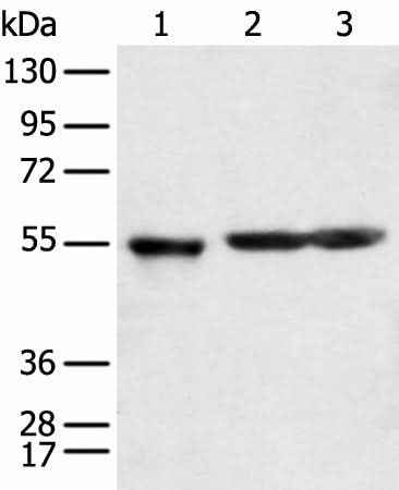 Anti-Human/Mouse KCTD16 Antibody